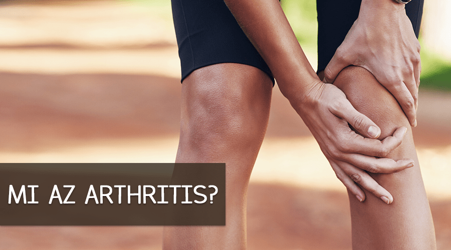 Az arthritis az ízületek gyulladását, azoknak gyulladt állapotát jelenti.