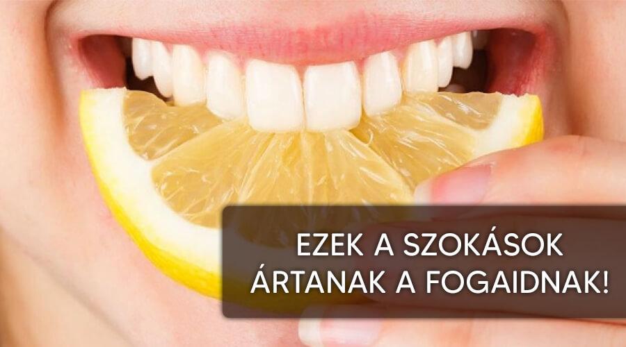 Rossz szokások amik miatt romlik a fog.