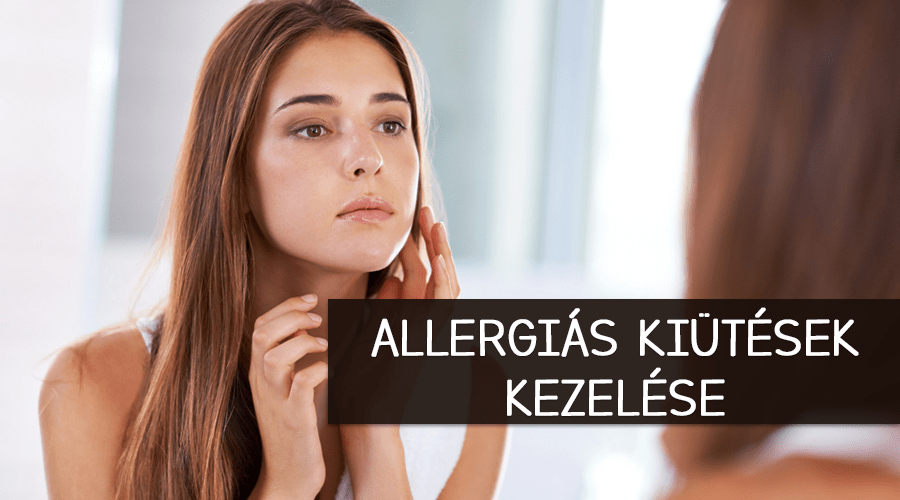 Az allergiás kiütések kezelése