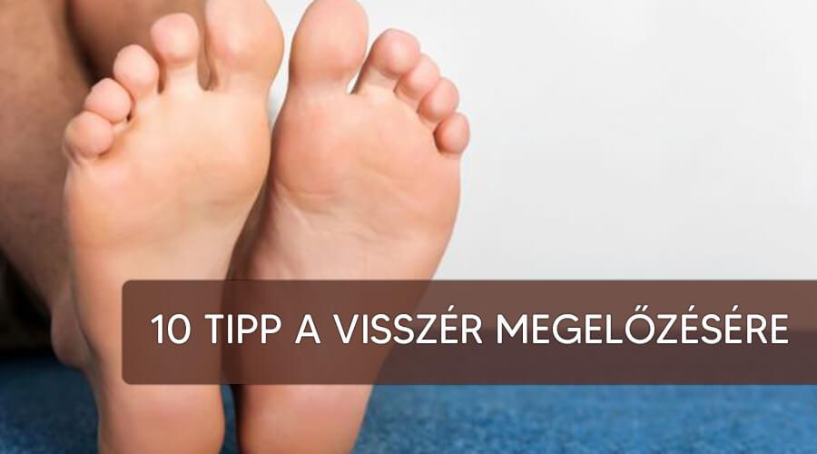Tippek visszérkezelésre