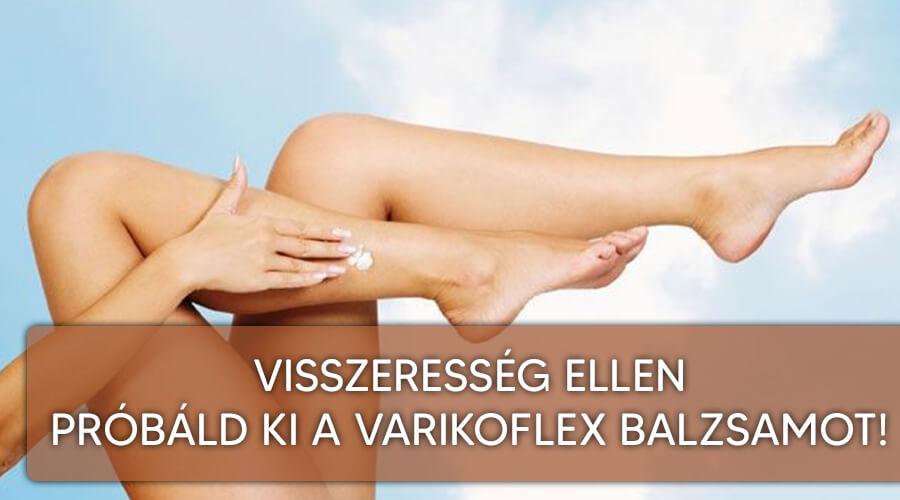 Varikoflex balzsam visszeresség ellen