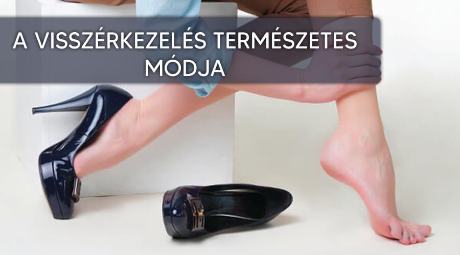 A visszérkezelés természetes módja.