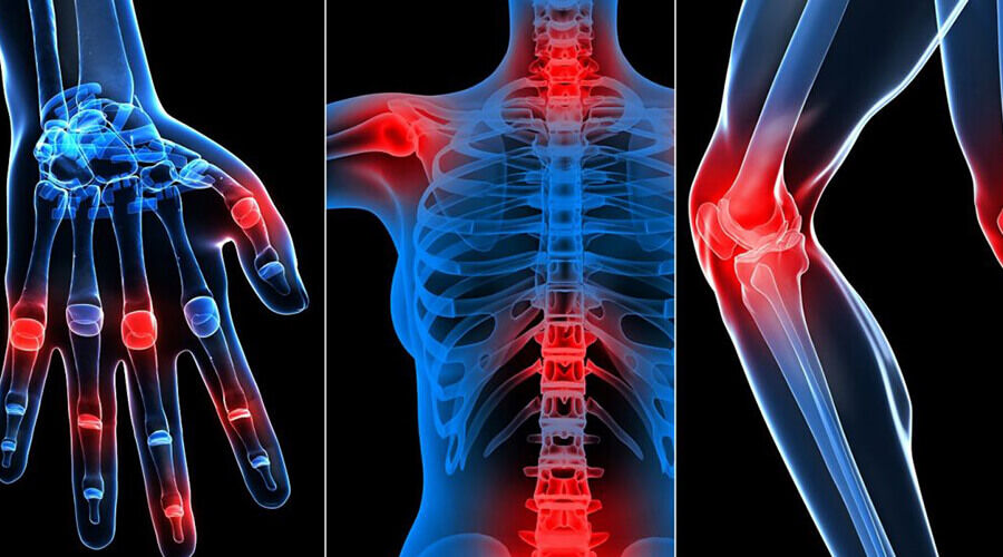 mit szúr a fájdalom a csípőízületben boka artritisz kezelésére szolgáló gyógyszerek