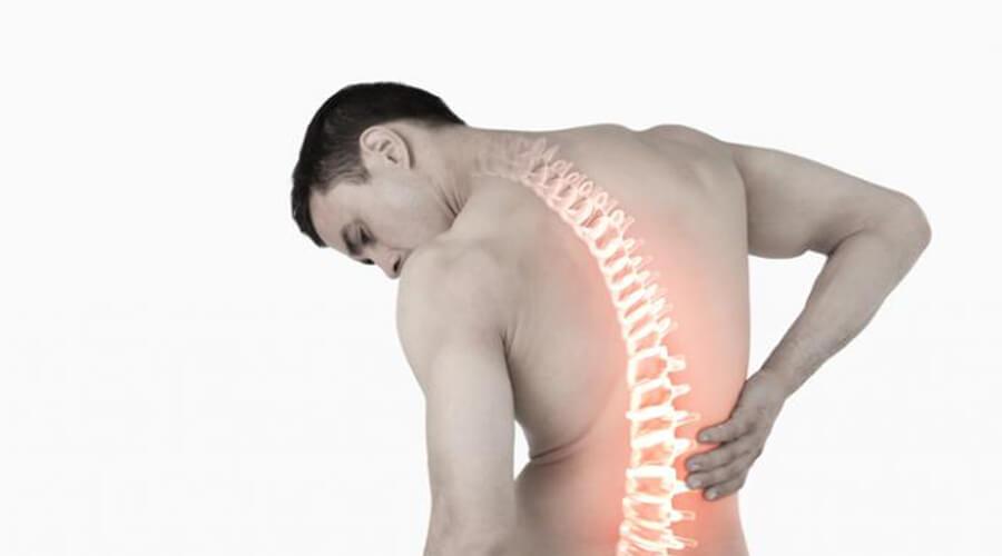 Causes of back pain.