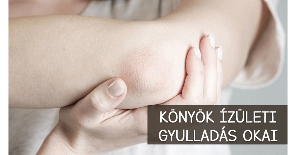 a könyökízületek ízületi ízületi gyulladása artrózis a térdben mint hogy kezeljék