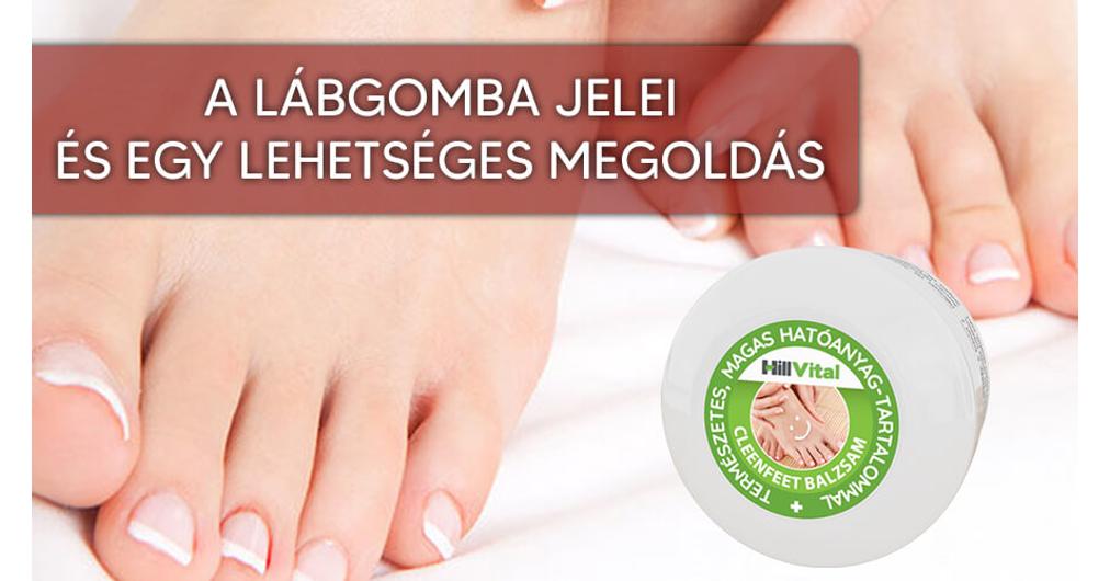 Láb- és körömgomba tünetei, okai, jelei, megelőzése, kezelése, gyógyítása