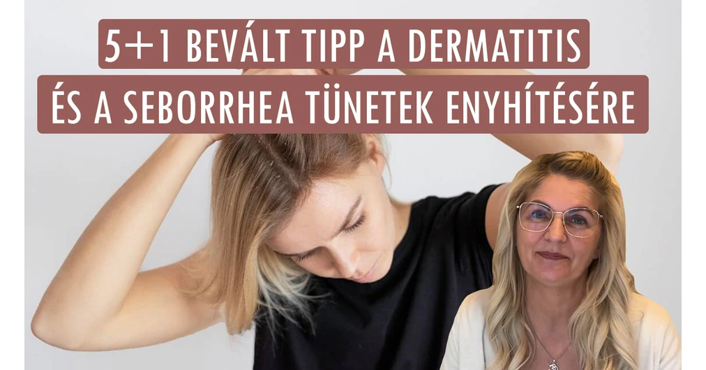Seborrhea és dermatitis kezelése otthon: 5+1tipp a tünetek enyhítésére
