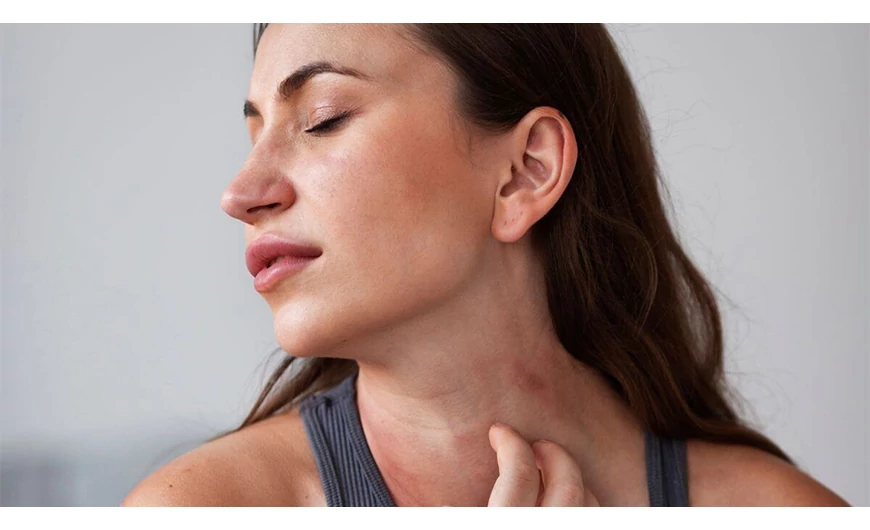 Seborrhoea és dermatitis kezelése otthon: 5+1 bevált tipp a tünetek enyhítésére.