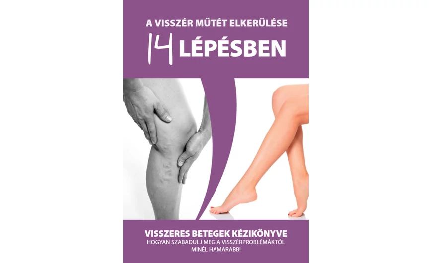 Visszeres betegek kézikönyve