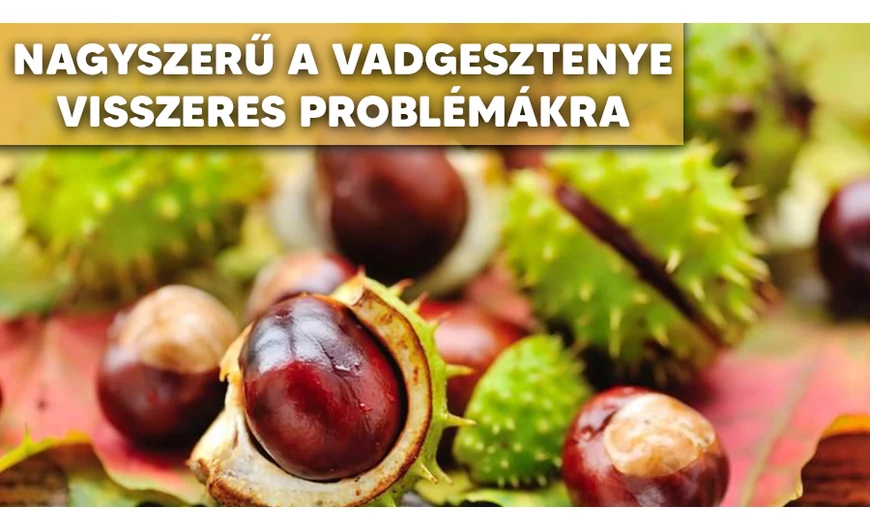 ​Vadgesztenye krém visszeres panaszok ellen