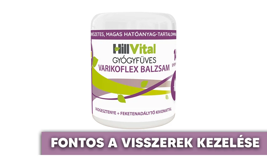 A visszérkezelés rendkívül fontos feladat
