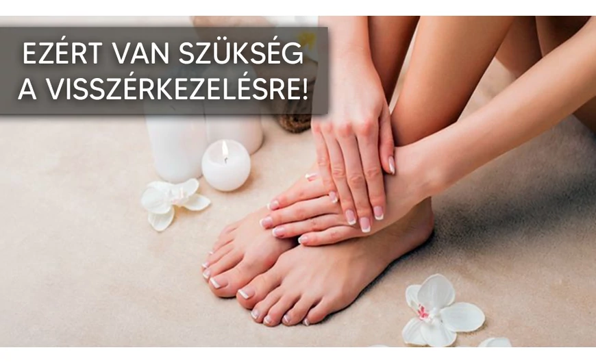 Miért van szükség a visszérkezelésre?