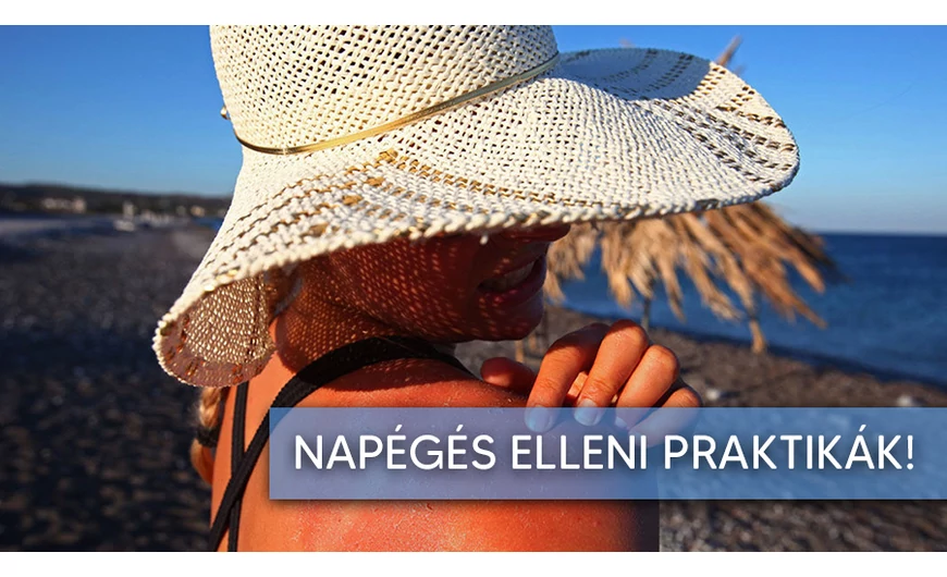 Házi praktikák napégésre