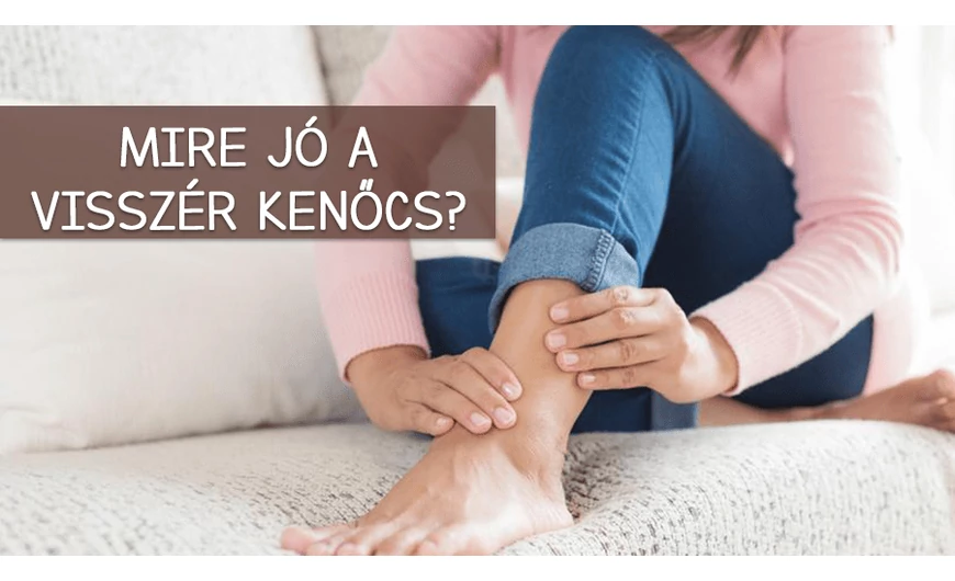 Mire jó a visszér kenőcs?