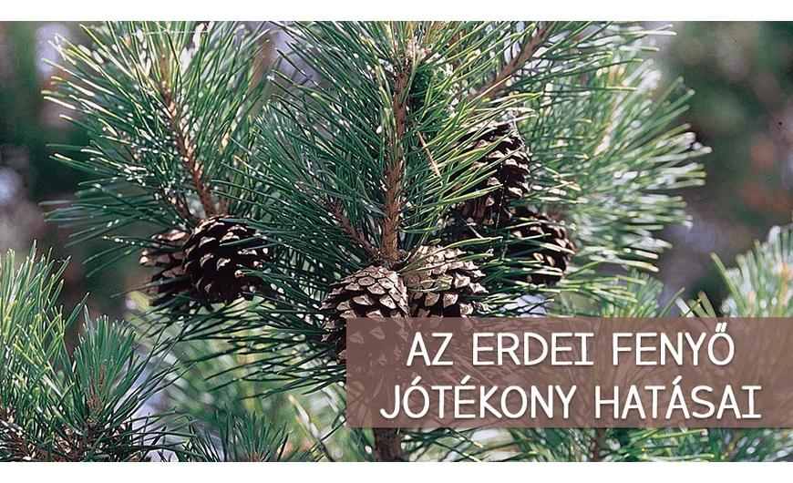 Nemcsak szép, hasznos is: az erdei fenyő 3+1 élettani előnye, amiről érdemes tudni
