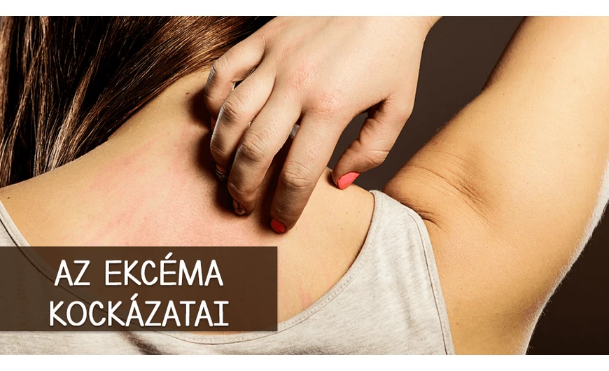 Az atópiás dermatitis 3 rejtett kockázata