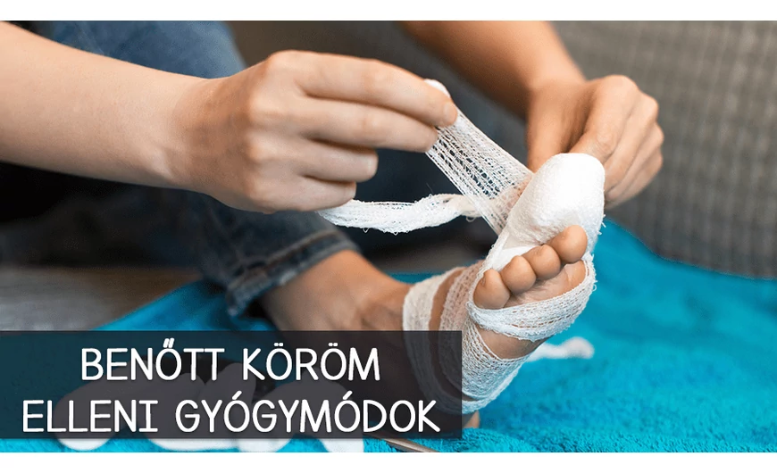 Mit tehetünk benőtt köröm ellen?
