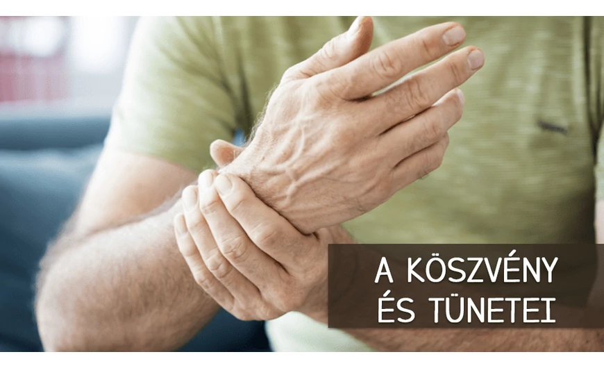 A köszvény tünetei és természetes kezelése