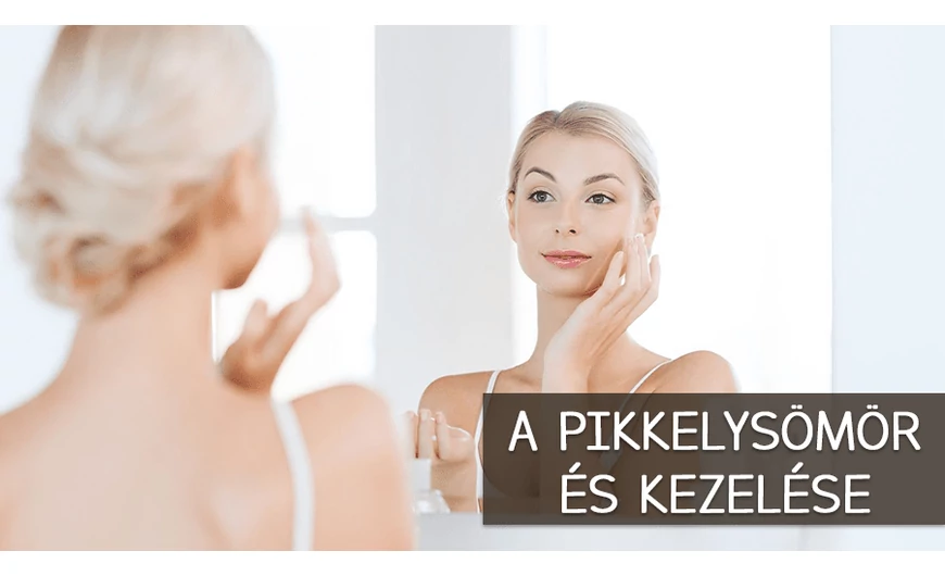 A pikkelysömör és kezelése