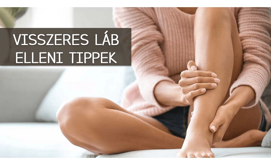 A visszeres láb nem csak esztétikai probléma
