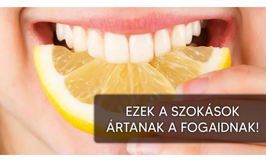 Néhány rossz szokás, amivel ártunk a fogunknak