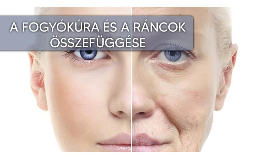 Fogyókúra és ráncosodás