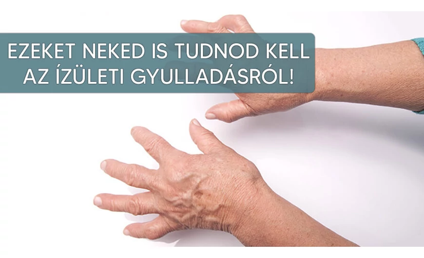 Minden amit tudni szeretnél és tudni kell az ízületi gyulladásról!