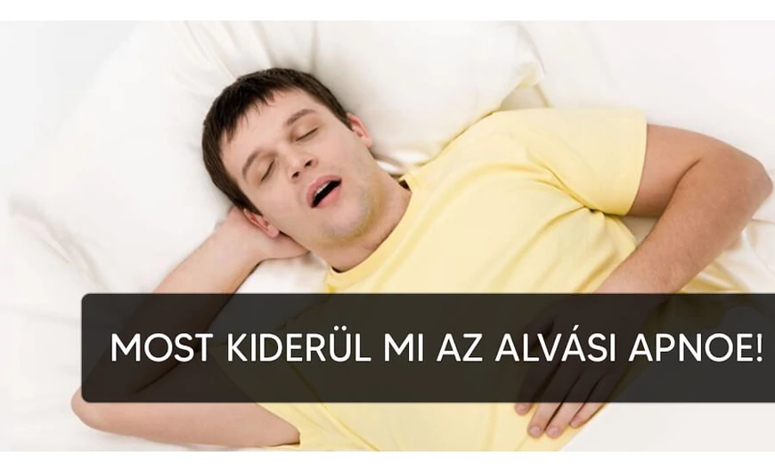Mi az alvási apnoe? 