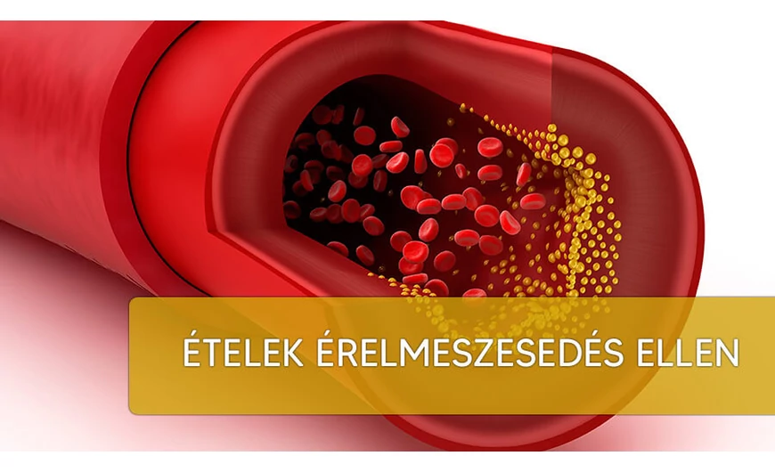 Életmentő ételek érelmeszesedés ellen