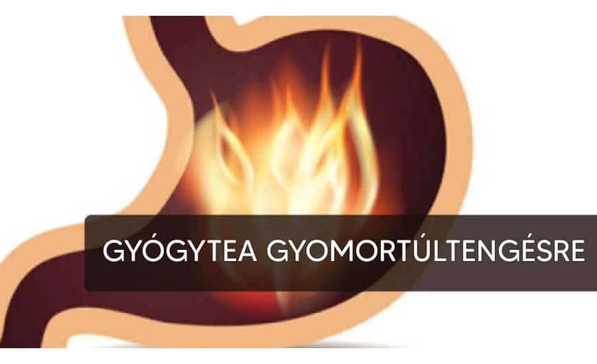Kitűnő tea gyomorsavtúltengésre