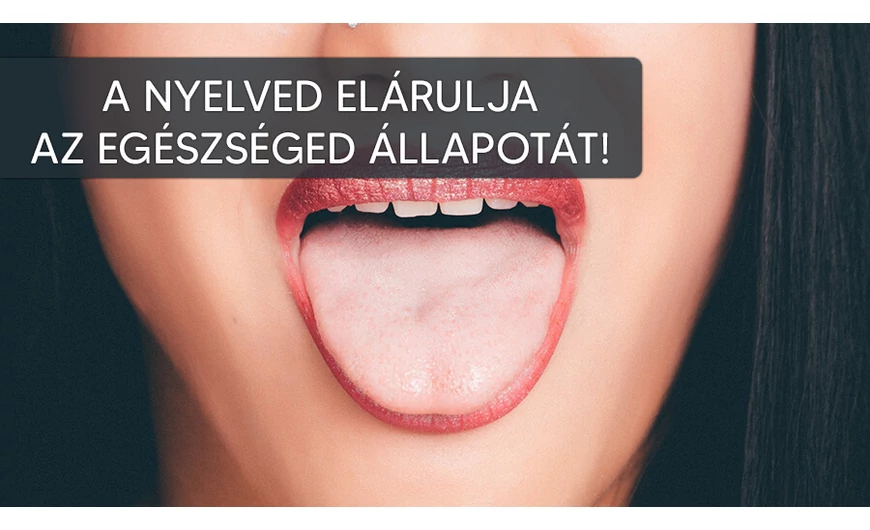 Tudd meg mire következtethetsz a nyelved állapotáról