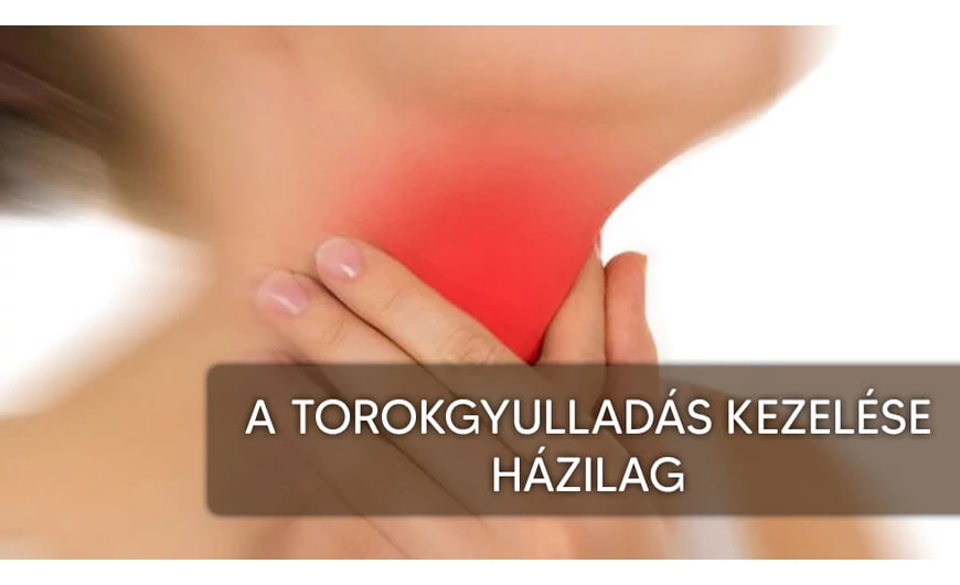 Torokgyulladás kezelése házilag