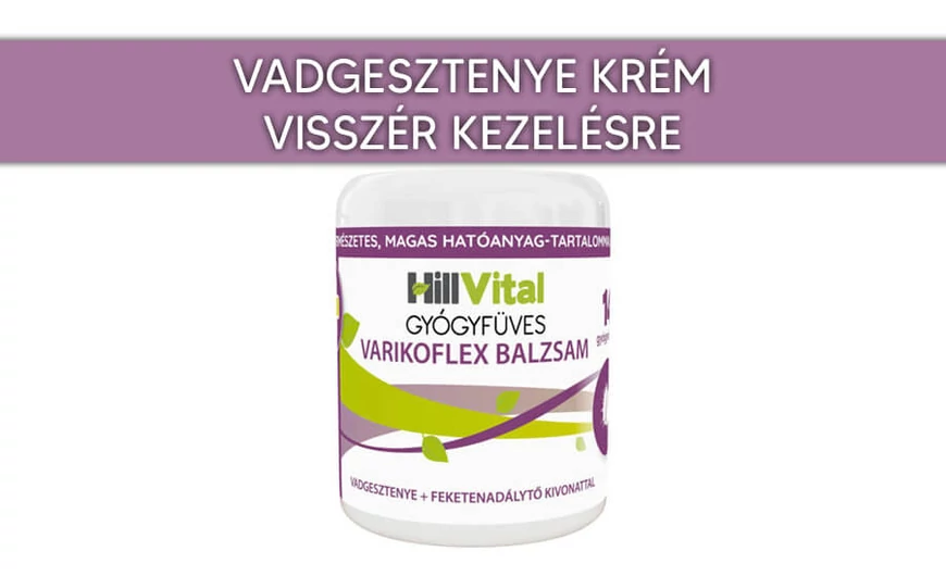 ​Vadgesztenye krém visszér kezelésére
