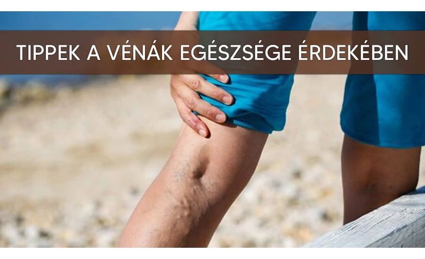 Így tartsd egészségesen a vénáid