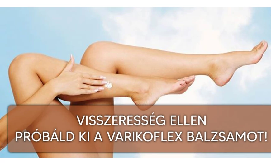 ​Varikoflex balzsam visszeresség ellen