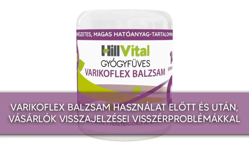 Varikoflex balzsam használat előtt és után, vásárlók visszajelzései visszérproblémákkal