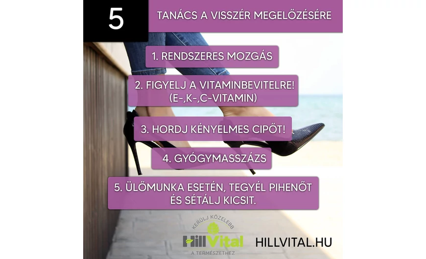 5 tanács a visszér megelőzésére