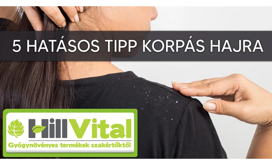5 megoldás korpás hajra