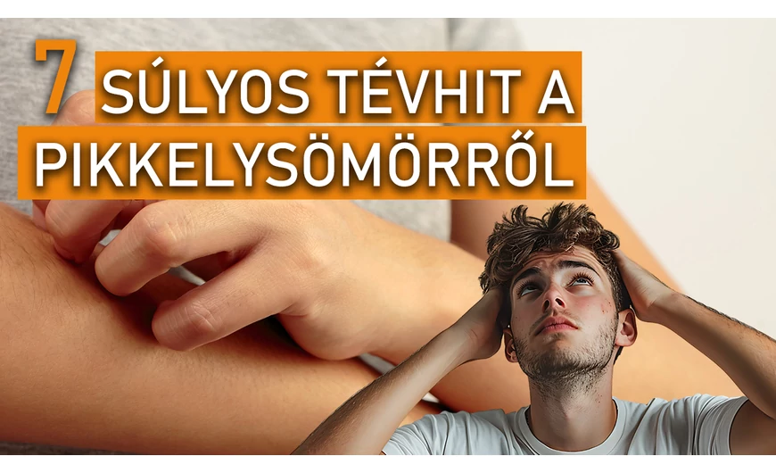 7 súlyos tévhit a pikkelysömörről