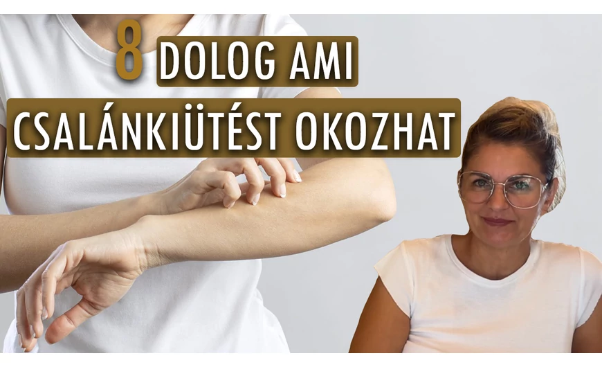 Mi állhat a csalánkiütés hátterében? Fedezd fel most!