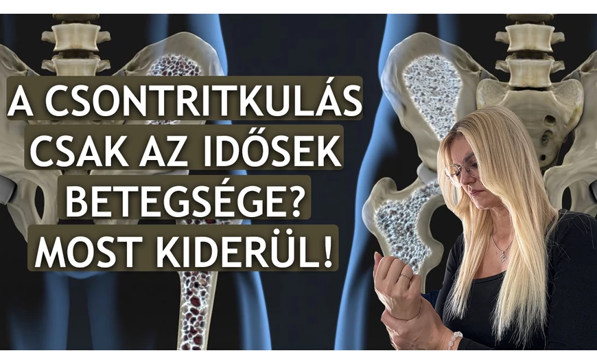 A csontritkulás csak az idősek betegsége? Most kiderül!