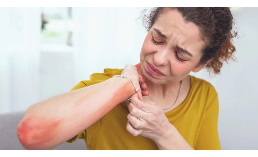 Dermatitis vagyis a kellemetlen bőrgyulladásos betegség
