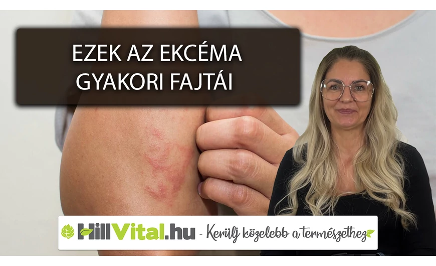 Az ekcéma leggyakoribb fajtái