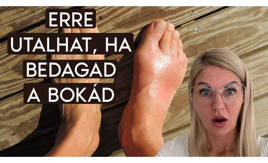 Erre utalhat, ha bedagad a bokád!
