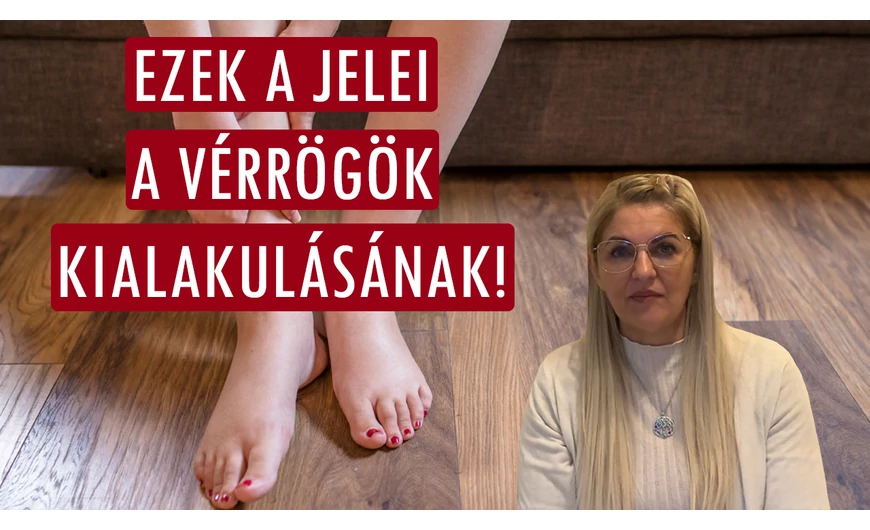 Ezek a jelei a vérrögök kialakulásának!