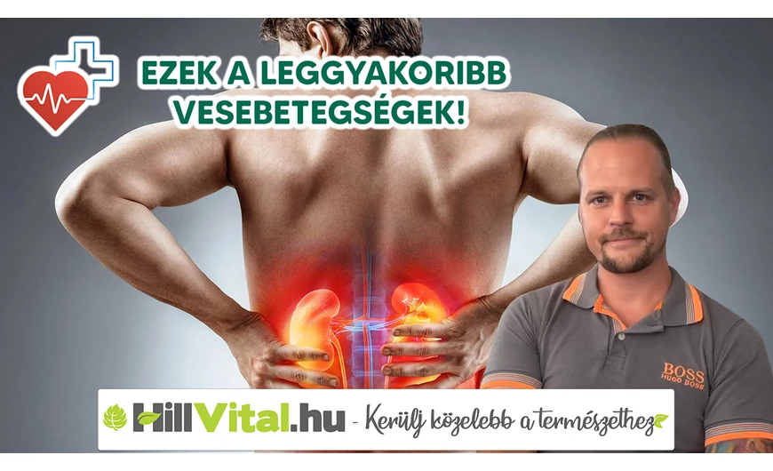 Dr. Kiss Csaba: „Ezek a leggyakoribb vesebetegségek!”