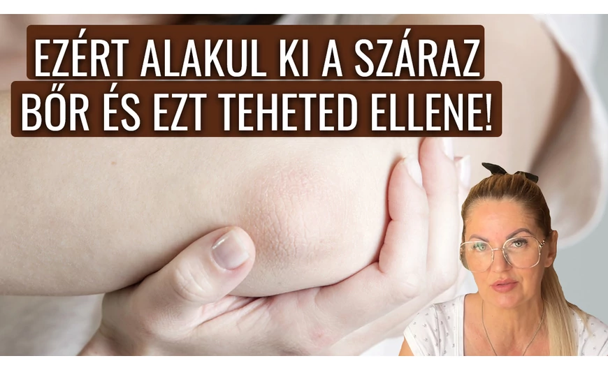 Ezért alakul ki a száraz bőr és ezt teheted ellene!