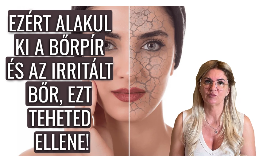 Ezért alakul ki a bőrpír és az irritált bőr, és ezt teheted ellene!
