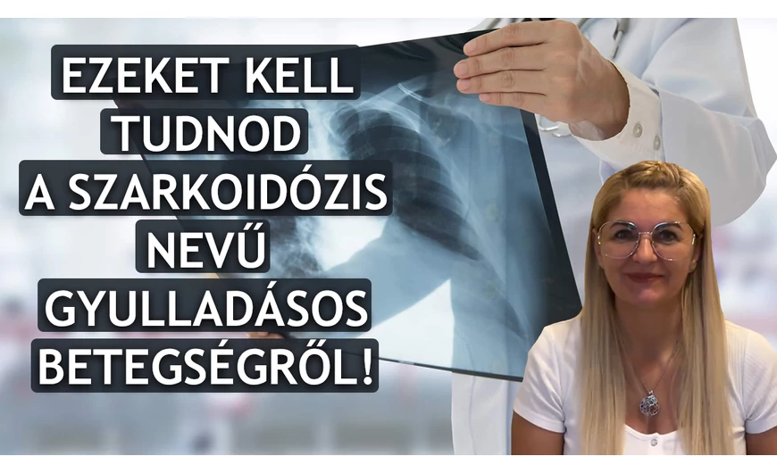 A szarkoidózis egy krónikus gyulladásos betegség!