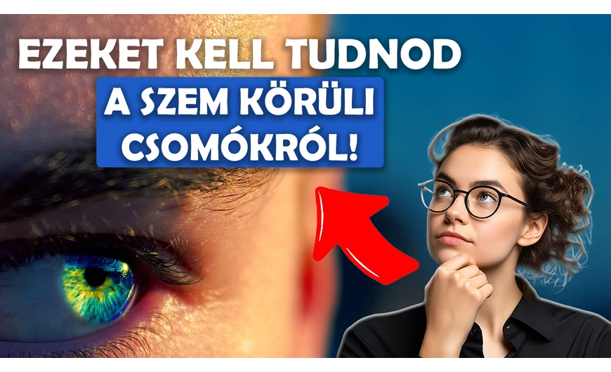 Ezeket kell tudnod a szem körüli csomókról!